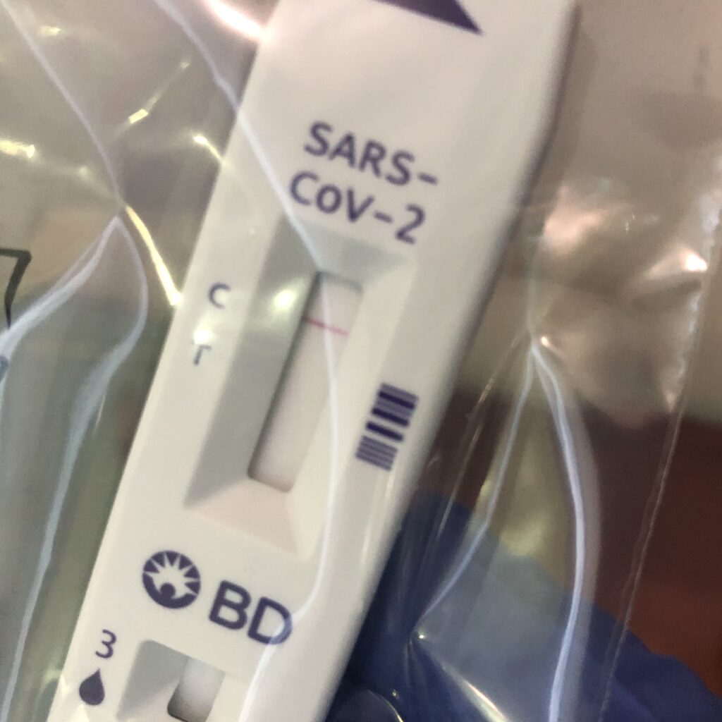 Covid19 PCR Test Review Atas Cheapo